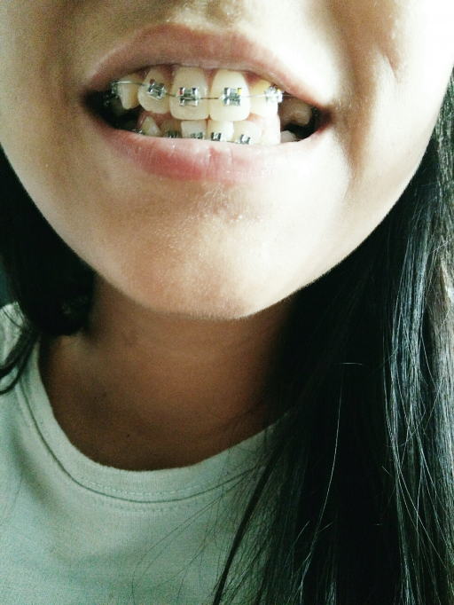 云南省提升*部*肤医院排名前十名详情一览(云南雨芮医学整形美容口碑人气持续飙升)